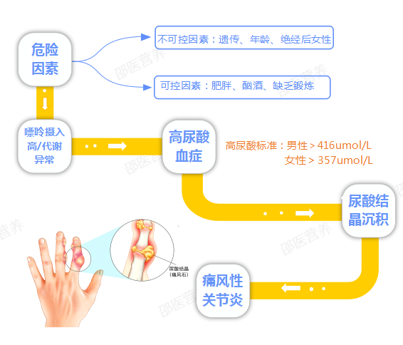 痛风为什么偏爱男性？你最关心的问题都在这里