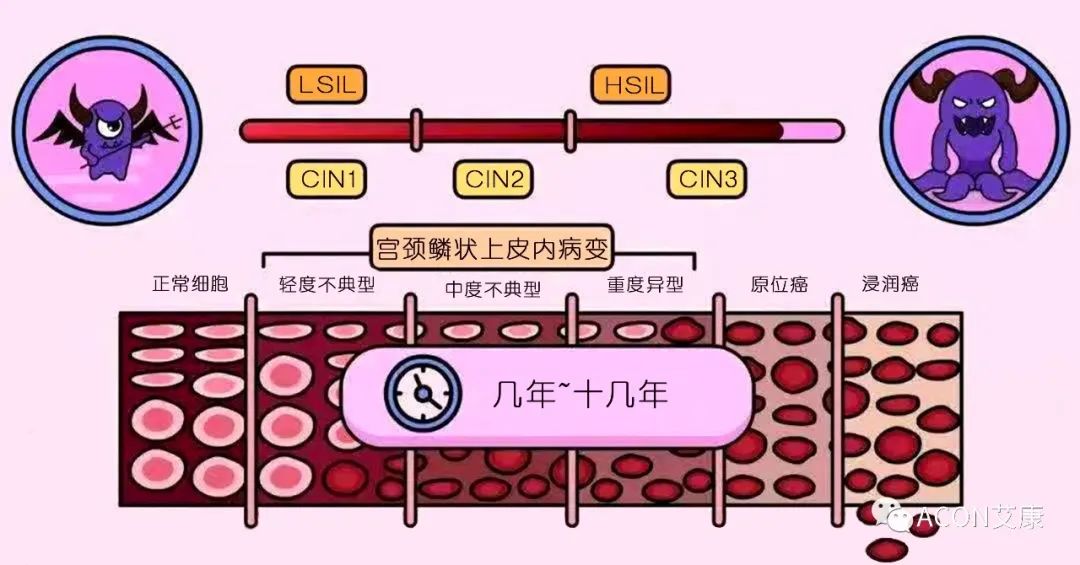 全球首次承诺消除一种癌症，预计到2050年将挽救500万人的生命