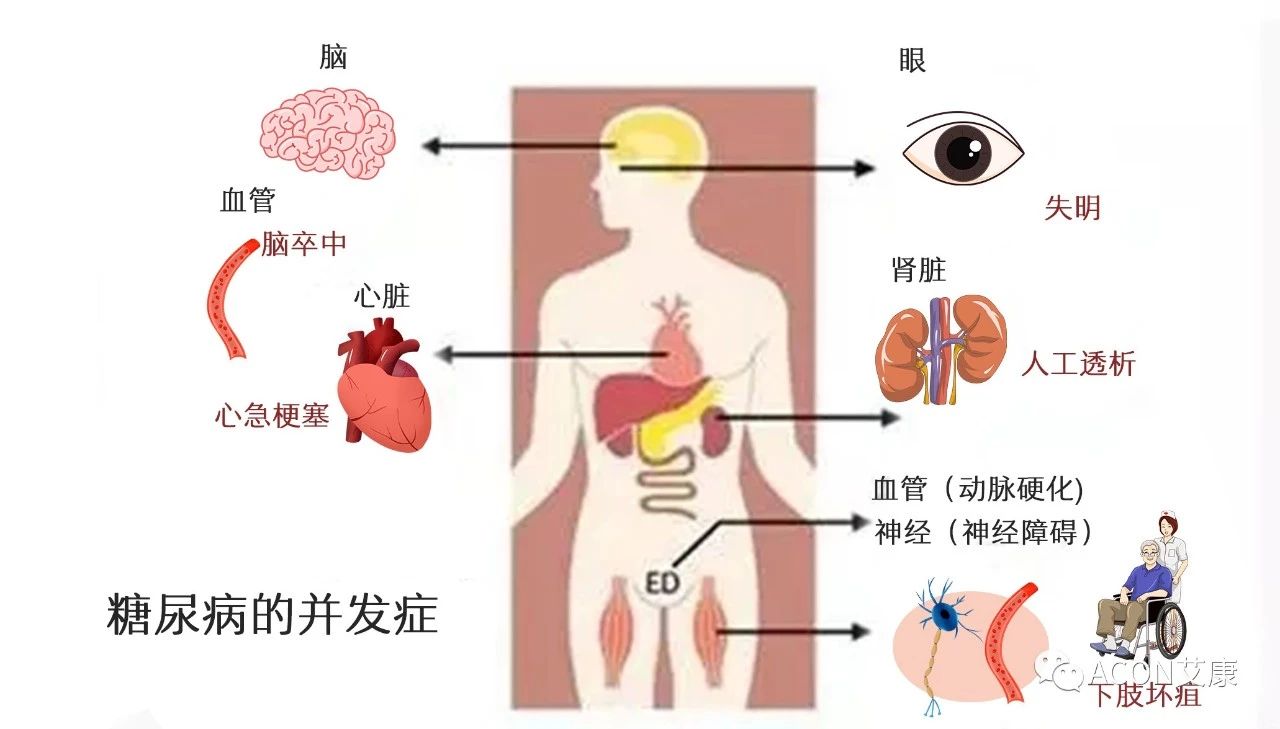 爆上热搜，因爆发型糖尿病进入ICU，有哪些教训值得我们汲取